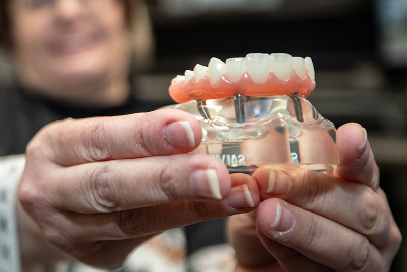 close up of full mouth dental implants