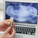 A dental professional holds a dental implant model while pointing at a dental X-ray on a laptop screen.