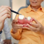 Closeup of unrecognizable dentist pointing at tooth model while explaining dental implant surgery to patient in clinic, discussing the dental implant treatment process