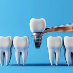 Dental teeth implants and Healthy white teeth. Oral health and dental inspection teeth.