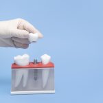 A hand in a white glove holds a model of a tooth implant blue table and background