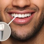 Happy man with perfect teeth smiling on grey background, closeup. Illustration of dental implant