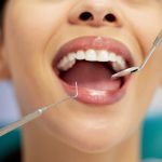 A friendly "implant doctor" is consulting with a patient, pointing to a digital scan of their mouth while explaining the dental implant procedure. No text on the image.